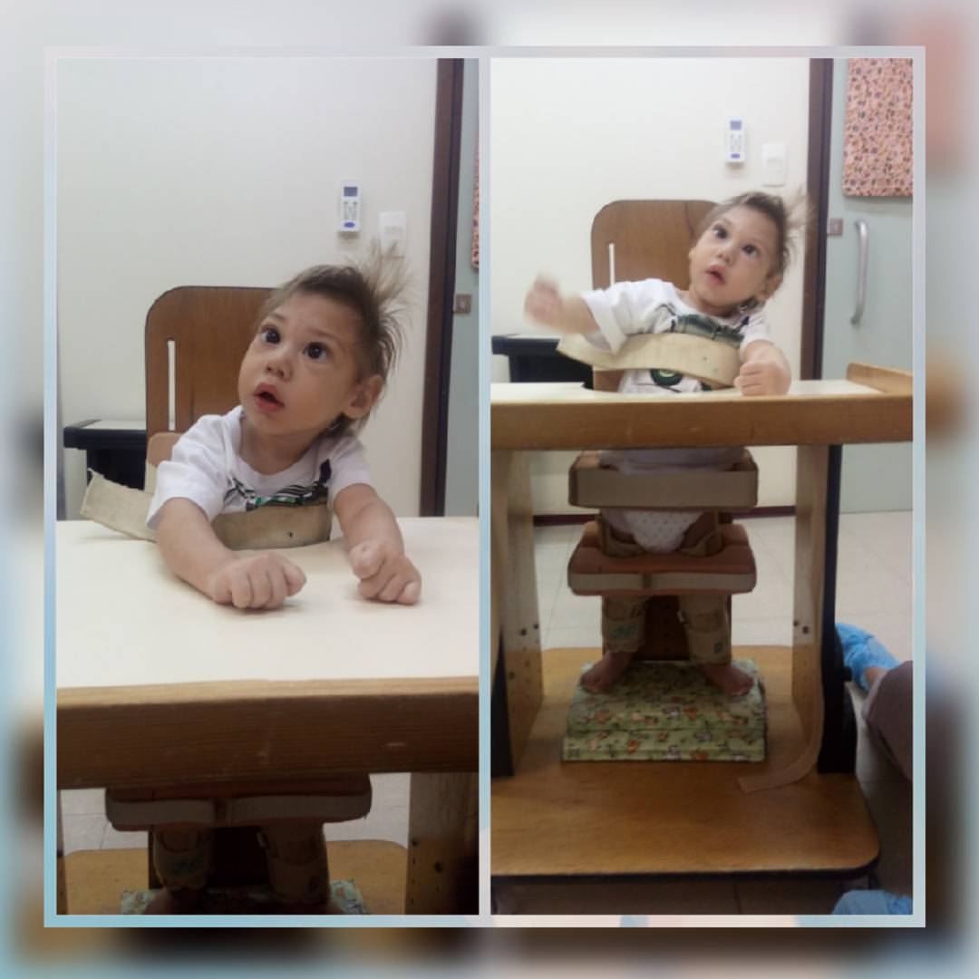 Felipe teve alguns acompanhamentos na AACD