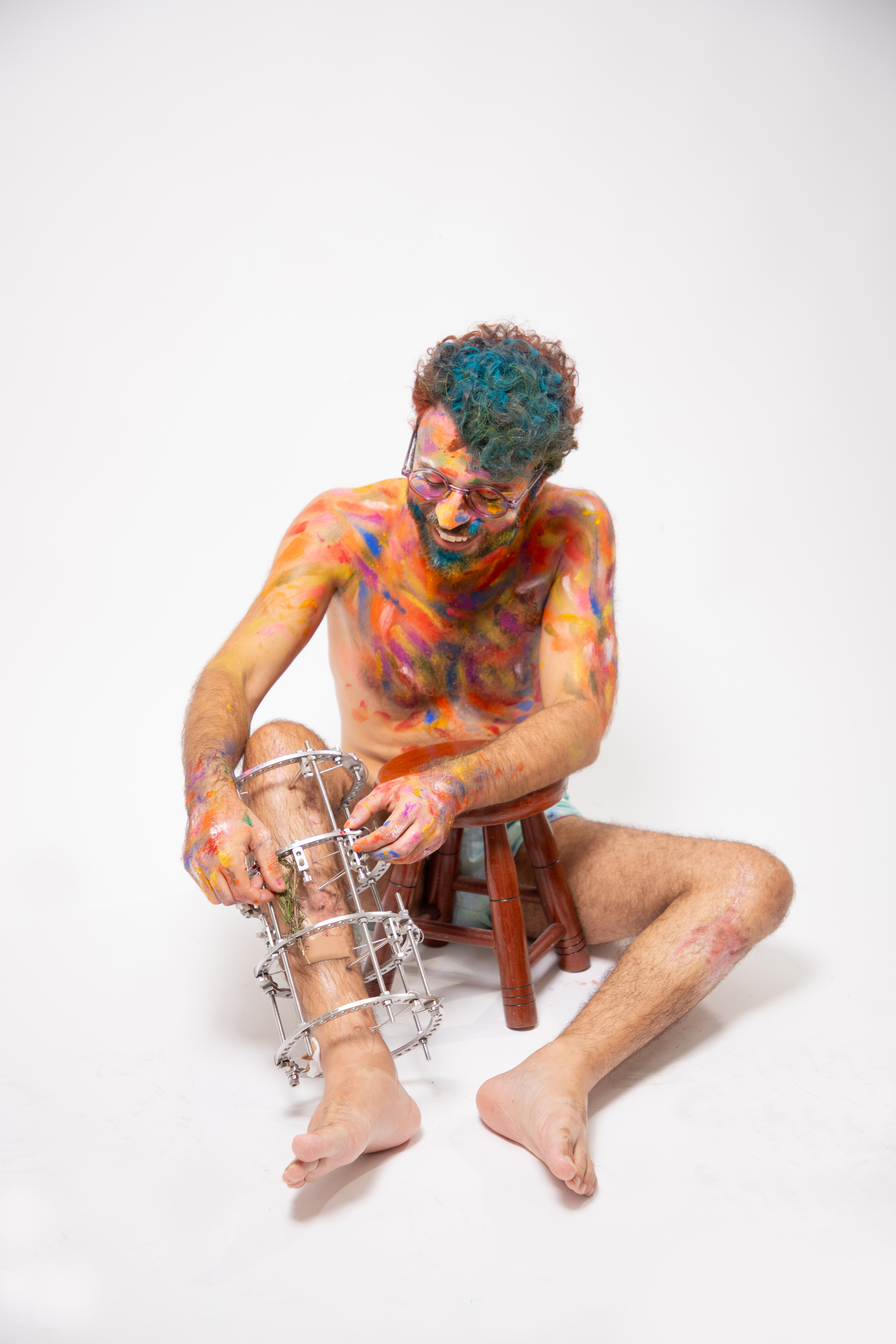 Minhas pernas quebradas