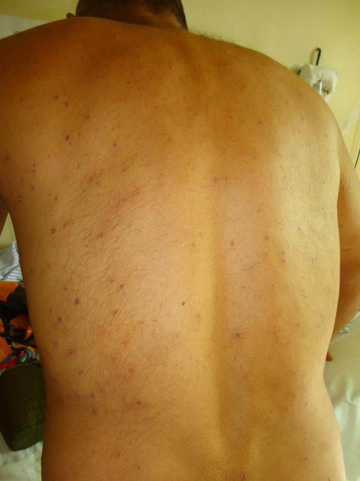 Estava recebendo últimos medicamentos após alta hospitalar