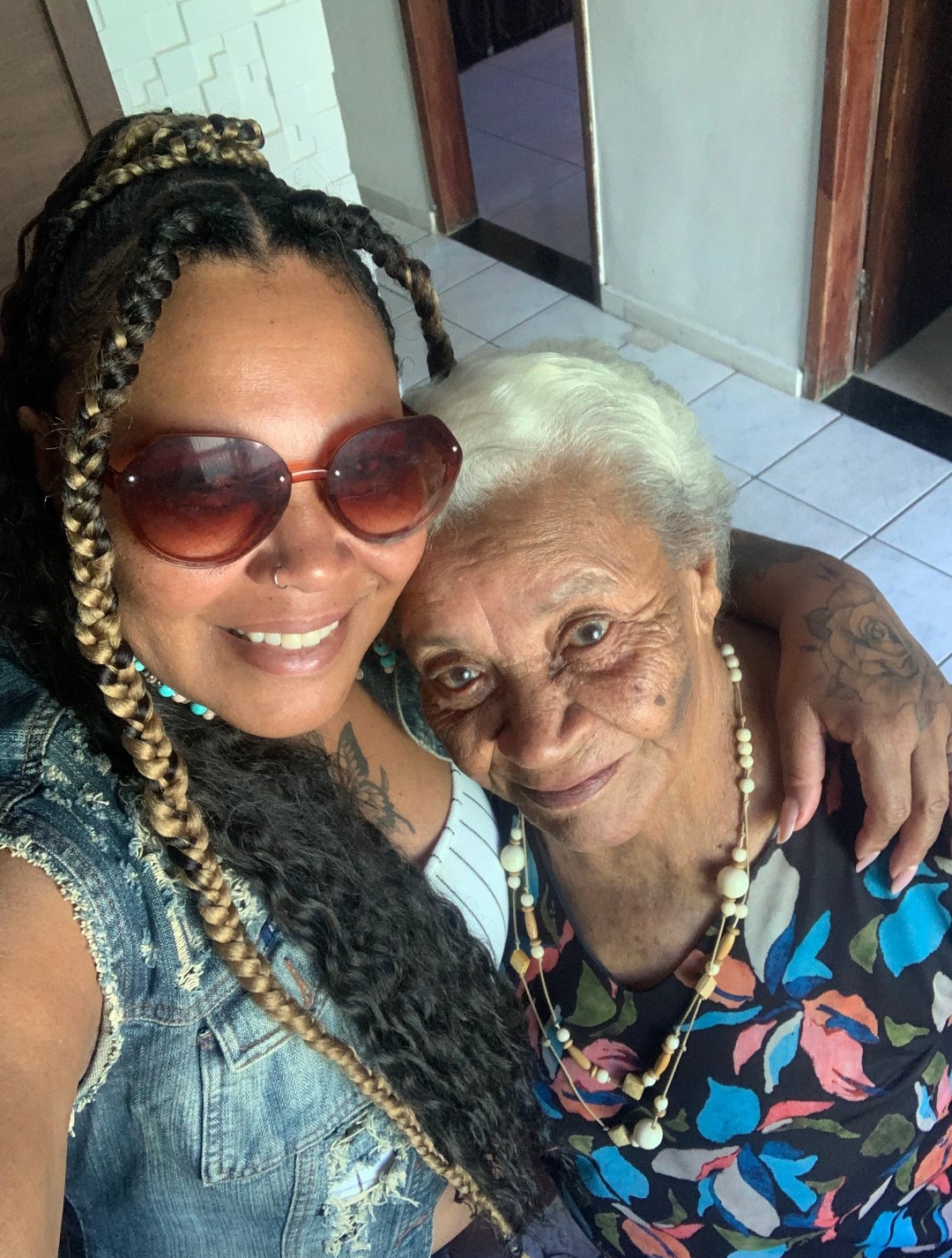 Antes e depois do alzheimer 